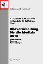 Bildverarbeitung für die Medizin 2012: Algorithmen - Systeme - Anwendungen. Proceedings des Workshops vom 18. bis 20. März 2012 in Berlin