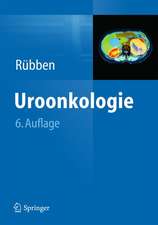 Uroonkologie