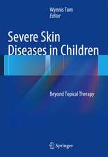 Severe Skin Diseases in Children: Beyond Topical Therapy