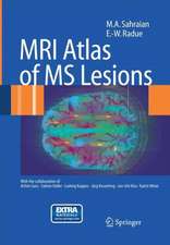 MRI Atlas of MS Lesions