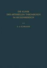 Die Klinik der Arteriellen Thrombosen im Beckenbereich: Pathogenese, Untersuchungsmethoden Diagnostik und Therapie