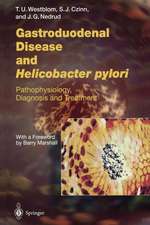 Gastroduodenal Disease and Helicobacter pylori: Pathophysiology, Diagnosis and Treatment