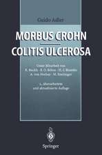 Morbus Crohn - Colitis ulcerosa