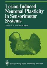 Lesion-Induced Neuronal Plasticity in Sensorimotor Systems