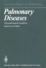 Pulmonary Diseases