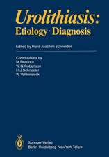 Urolithiasis: Etiology · Diagnosis