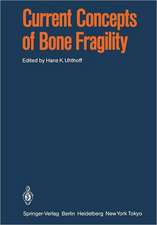 Current Concepts of Bone Fragility