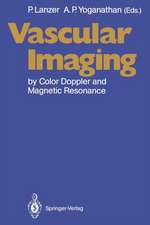 Vascular Imaging by Color Doppler and Magnetic Resonance