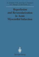 Reperfusion and Revascularization in Acute Myocardial Infarction