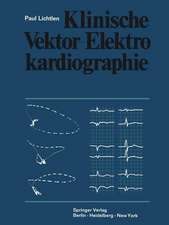 Klinische Vektor-Elektrokardiographie