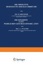 Die Operative Beseitigung der Bauchbrüche. Die Eingriffe an den Weiblichen Geschlechtsorganen