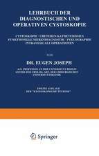 Lehrbuch der Diagnostischen und Operativen Cystoskopie: Cystoskopie · Ureterenkatheterismus Funktionelle Nierendiagnostik · Pyelographie Intravesicale Operationen