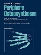 Periphere Osteosynthesen: unter Verwendung des Kleinfragment-Instrumentariums der AO