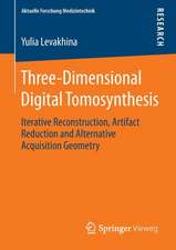 Three-Dimensional Digital Tomosynthesis: Iterative Reconstruction, Artifact Reduction and Alternative Acquisition Geometry