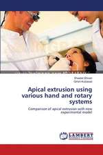 Apical extrusion using various hand and rotary systems