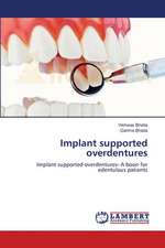 Implant supported overdentures