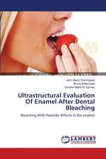 Ultrastructural Evaluation Of Enamel After Dental Bleaching