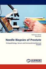 Needle Biopsies of Prostate