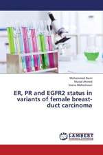 ER, PR and EGFR2 status in variants of female breast-duct carcinoma