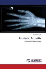 Psoriatic Arthritis