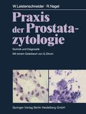 Praxis der Prostatazytologie: Technik und Diagnostik