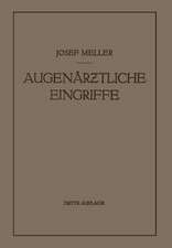 Augenärztliche Eingriffe: Ein Kurzes Handbuch für Angehende Augenärzte