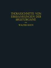 Thoraxschnitte von Erkrankungen der Brustorgane: Ein Atlas