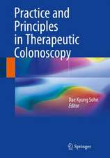 Practice and Principles in Therapeutic Colonoscopy