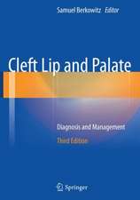 Cleft Lip and Palate