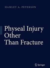 Physeal Injury Other Than Fracture