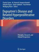 Dupuytren’s Disease and Related Hyperproliferative Disorders: Principles, Research, and Clinical Perspectives