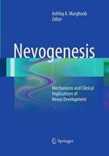 Nevogenesis: Mechanisms and Clinical Implications of Nevus Development