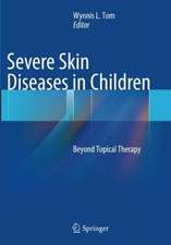 Severe Skin Diseases in Children: Beyond Topical Therapy