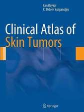 Clinical Atlas of Skin Tumors