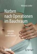 Narben nach Operationen im Bauchraum: Selbsthilfe mit dem Liedler-Konzept