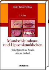 Mundschleimhaut- und Lippenkrankheiten