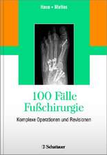 100 Fälle Fußchirurgie