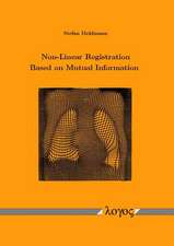 Non-Linear Registration Based on Mutual Information