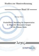 Probabilistic Modeling for Segmentation in Magnetic Resonance Images of the Human Brain