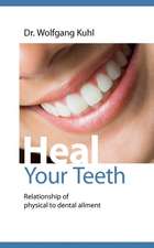 Heal Your Teeth: Der Sizilianer