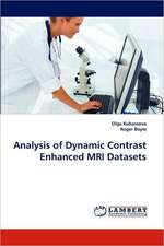 Kubassova, O: Analysis of Dynamic Contrast Enhanced MRI Data