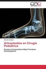 Artroplastias en Cirugia Podiatrica