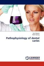 Pathophysiology of dental caries