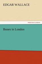 Bones in London