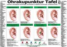 Ohrakupunktur Tafel - Indikation: Neurologische Erkrankungen, Nervensystem & Vegetative Erkrankungen