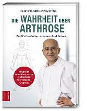 Die Wahrheit über Arthrose