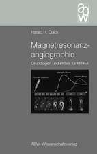 Magnetresonanzangiographie