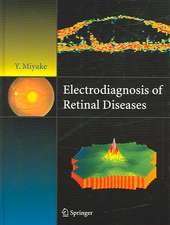 Electrodiagnosis of Retinal Disease