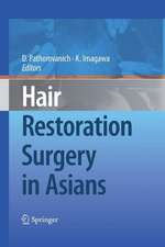 Hair Restoration Surgery in Asians