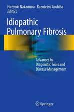 Idiopathic Pulmonary Fibrosis: Advances in Diagnostic Tools and Disease Management